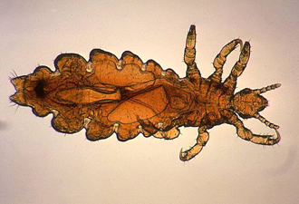 Head lice detail